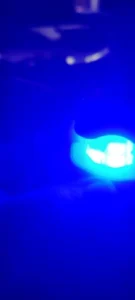 Click to view full screen Kit complet ClearNail™ photo review