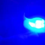 Kit complet ClearNail™ photo review